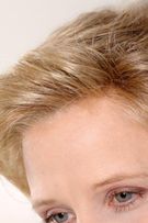 Angebote im medizinischen Zweithaarbreeich: Vorher und Nachher
